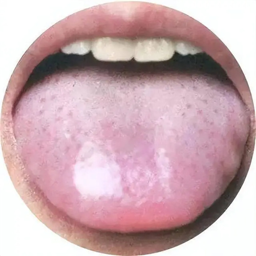详细说明